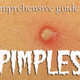 Illustration for article titled The Taxonomy Of Zits